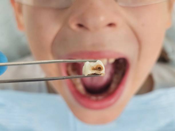 Best Mobile Emergency Dentist in Clio, MI
